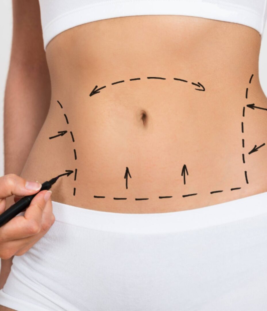 Fat Reduction Procedures