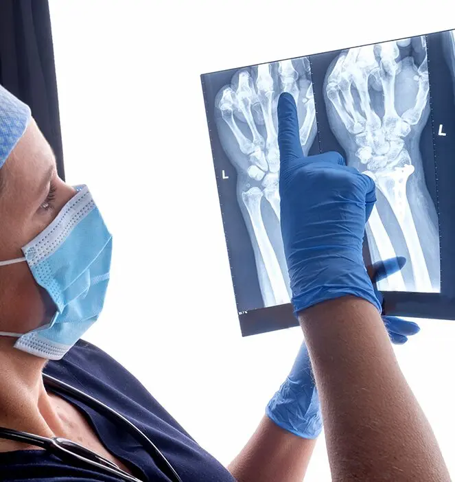 Doctor examines a patient's hand X-ray.